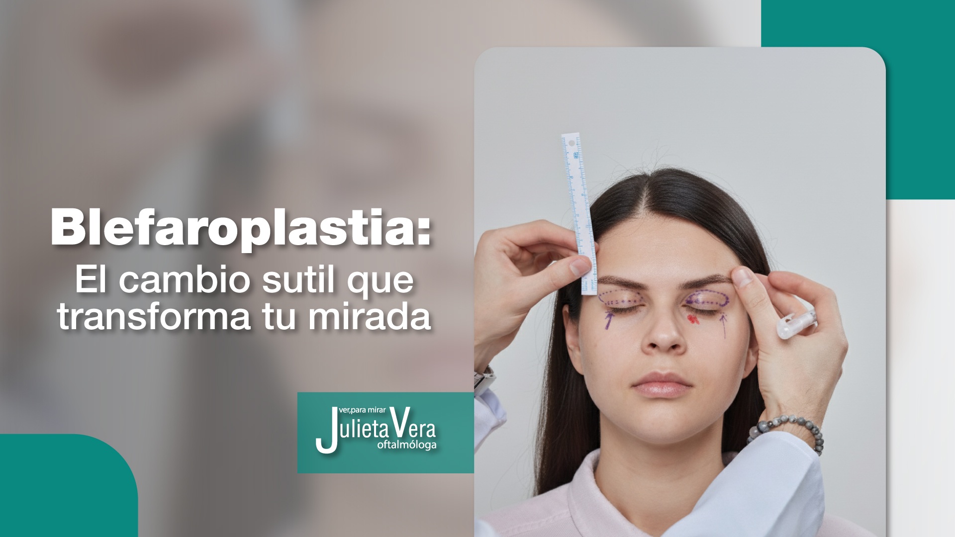 Blefaroplastia el cambio que le devuelve la frescura a tu mirada - Dra. Julieta Vera